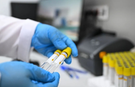 Belediye personellerinin test sonucu şaşkına çevirdi