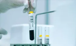 Nüfusun yüzde 2,1'i Akdeniz anemisi hastalığını taşıyor