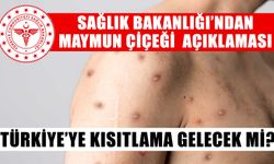 Sağlık Bakanlığı açıkladı: Maymun çiçeği için kısıtlama gelecek mi?