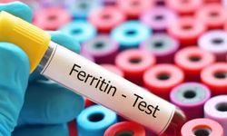 Ferritin nedir, kan tahlilinde değeri kaç olmalı? Ferritin düşüklüğü ve yüksekliği ne anlama gelir?