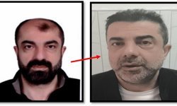Firari zanlı estetikle kimlik değiştirdi, 7 yıl sonra yakalandı