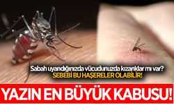 Geceleri kaşınarak mı uyanıyorsunuz? Sizi ne ısırıyor olabilir? İşte cevabı...