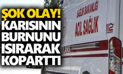 Şok olay! Karısının burnunu ısırarak koparttı