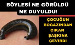 Küçük çocuğun boğazından çıkan şaşkına çevirdi