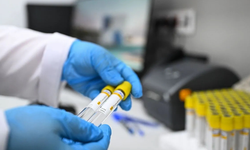 Belediye personellerinin test sonucu şaşkına çevirdi