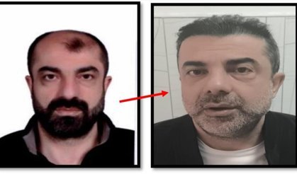 Firari zanlı estetikle kimlik değiştirdi, 7 yıl sonra yakalandı