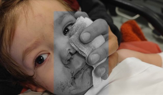 2 çocuğu yaralayan pitbullun sahibi tutuklandı