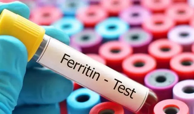 Ferritin nedir, kan tahlilinde değeri kaç olmalı? Ferritin düşüklüğü ve yüksekliği ne anlama gelir?