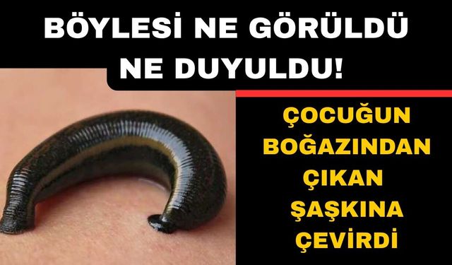 Küçük çocuğun boğazından çıkan şaşkına çevirdi