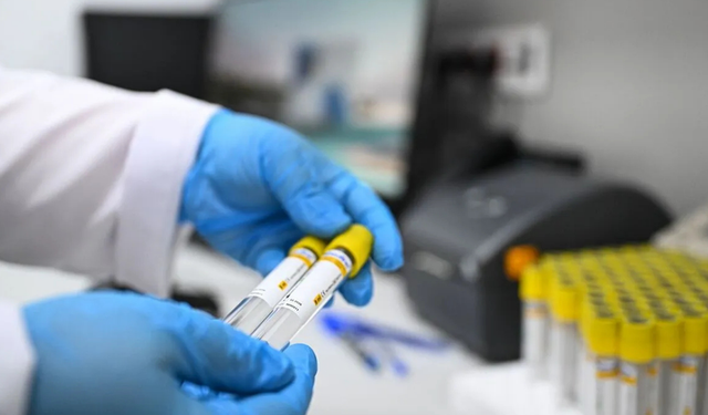 Belediye personellerinin test sonucu şaşkına çevirdi