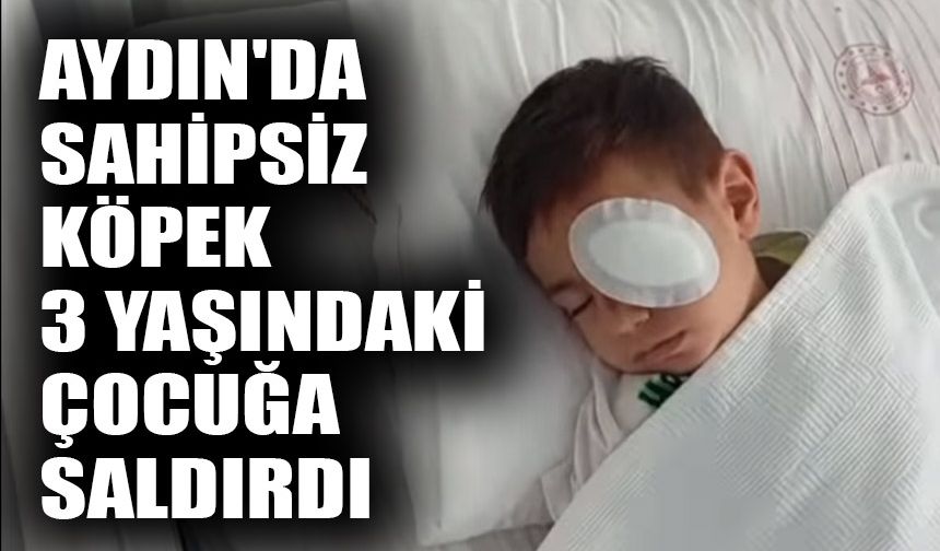 Aydın'da sahipsiz köpek 3 yaşındaki çocuğa saldırdı