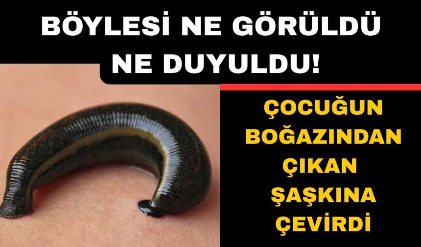 Küçük çocuğun boğazından çıkan şaşkına çevirdi