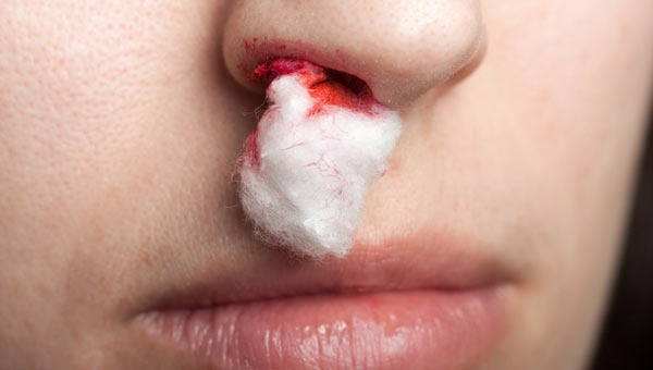 burun kanaması