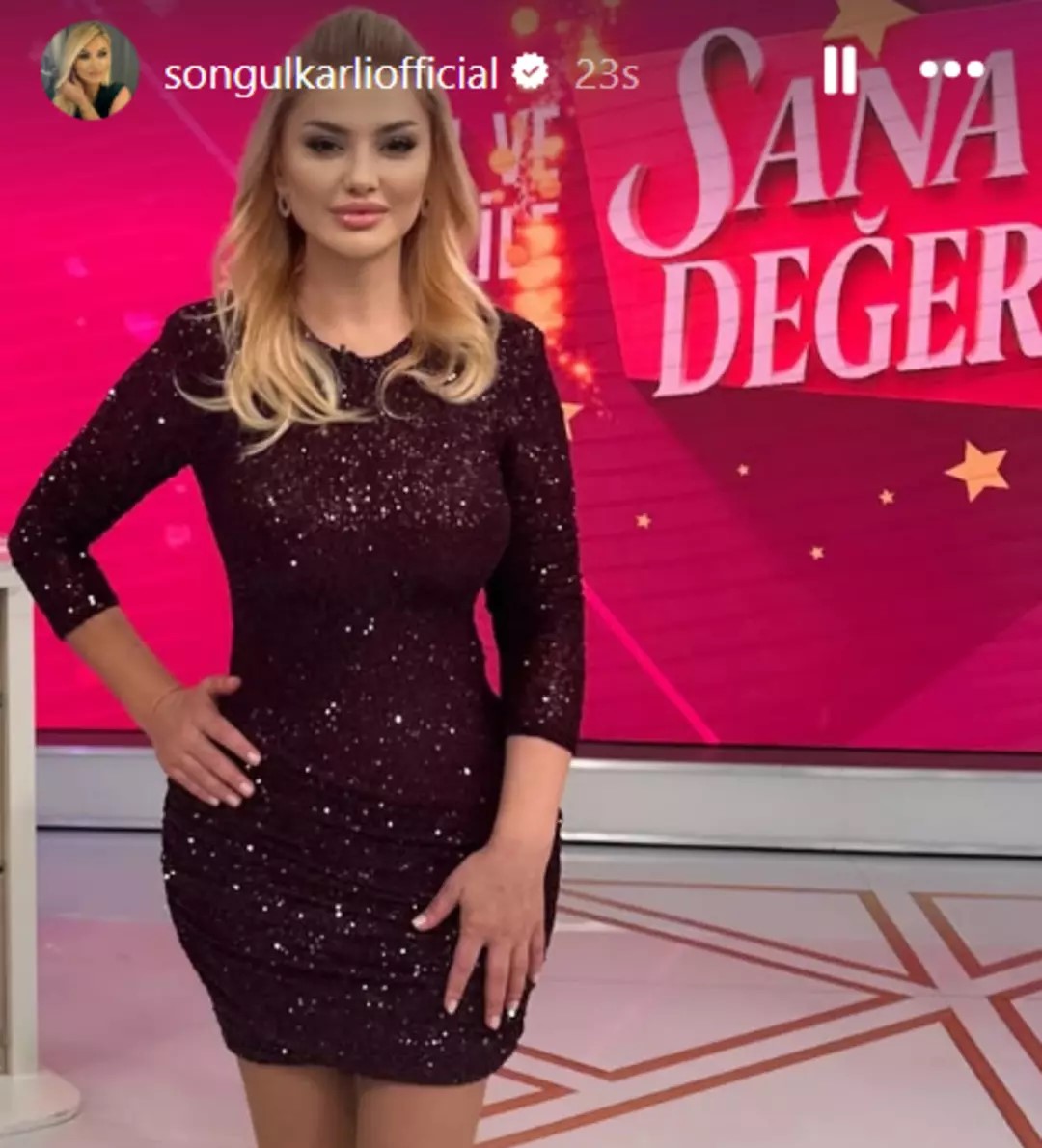 Songül Karlı Kalça Estetiği Mi Yaptırdı